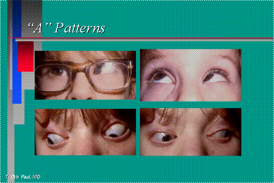 A patterns 