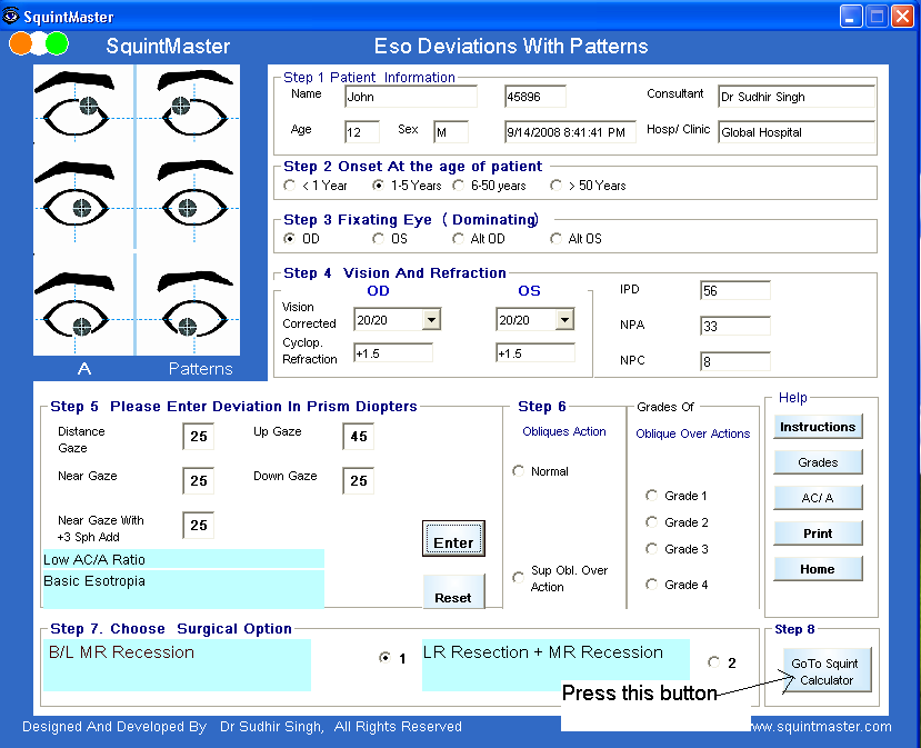 Management By SquintMaster Software Of Esotropia With A V Patterns